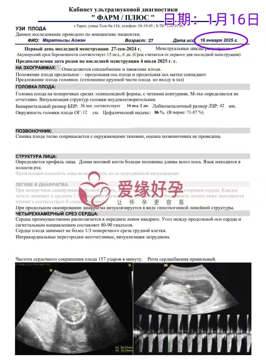 格鲁吉亚代孕代母孕16周产检顺利通过