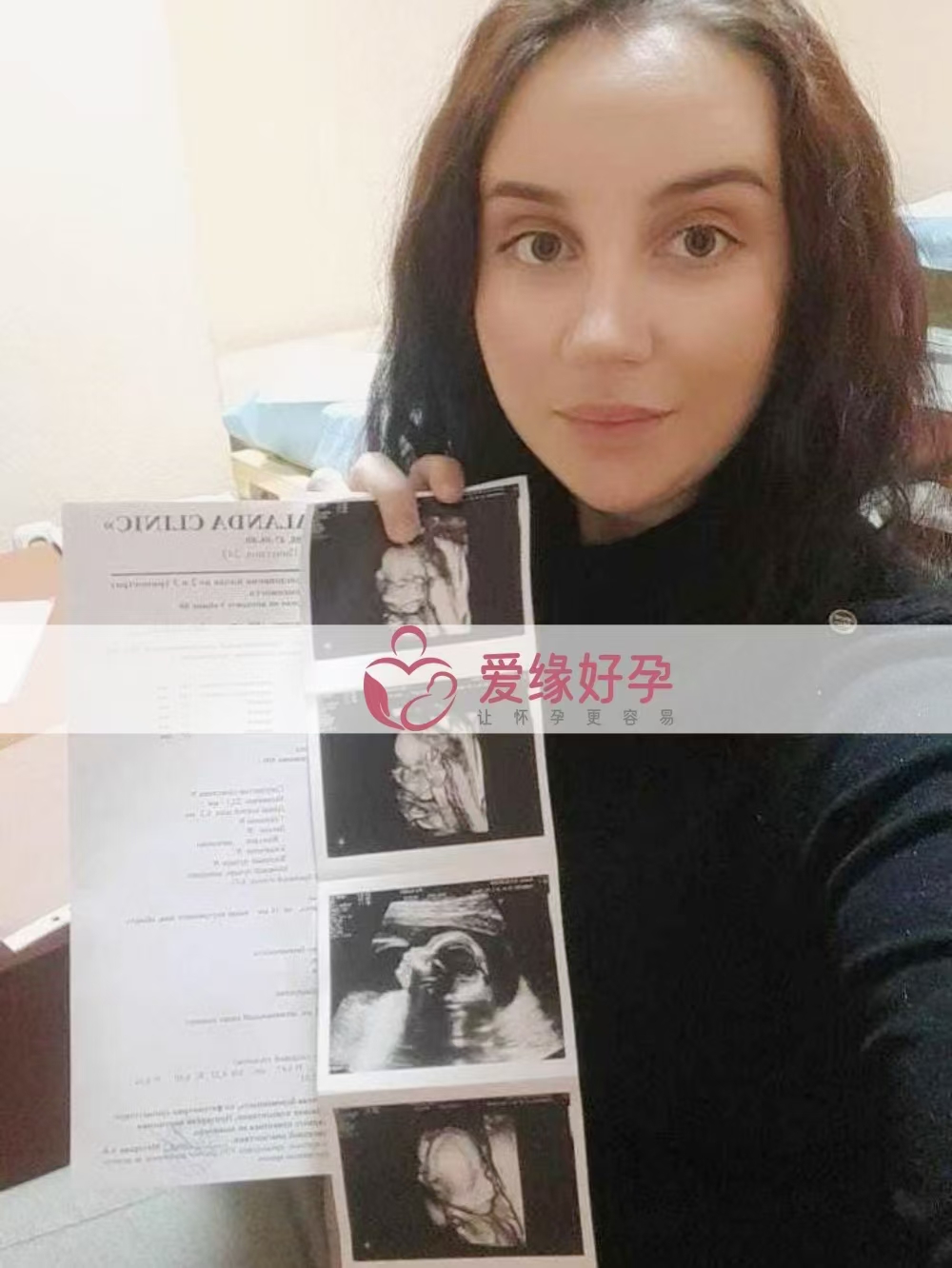 哈萨克斯坦代孕代母孕21周产检顺利通过