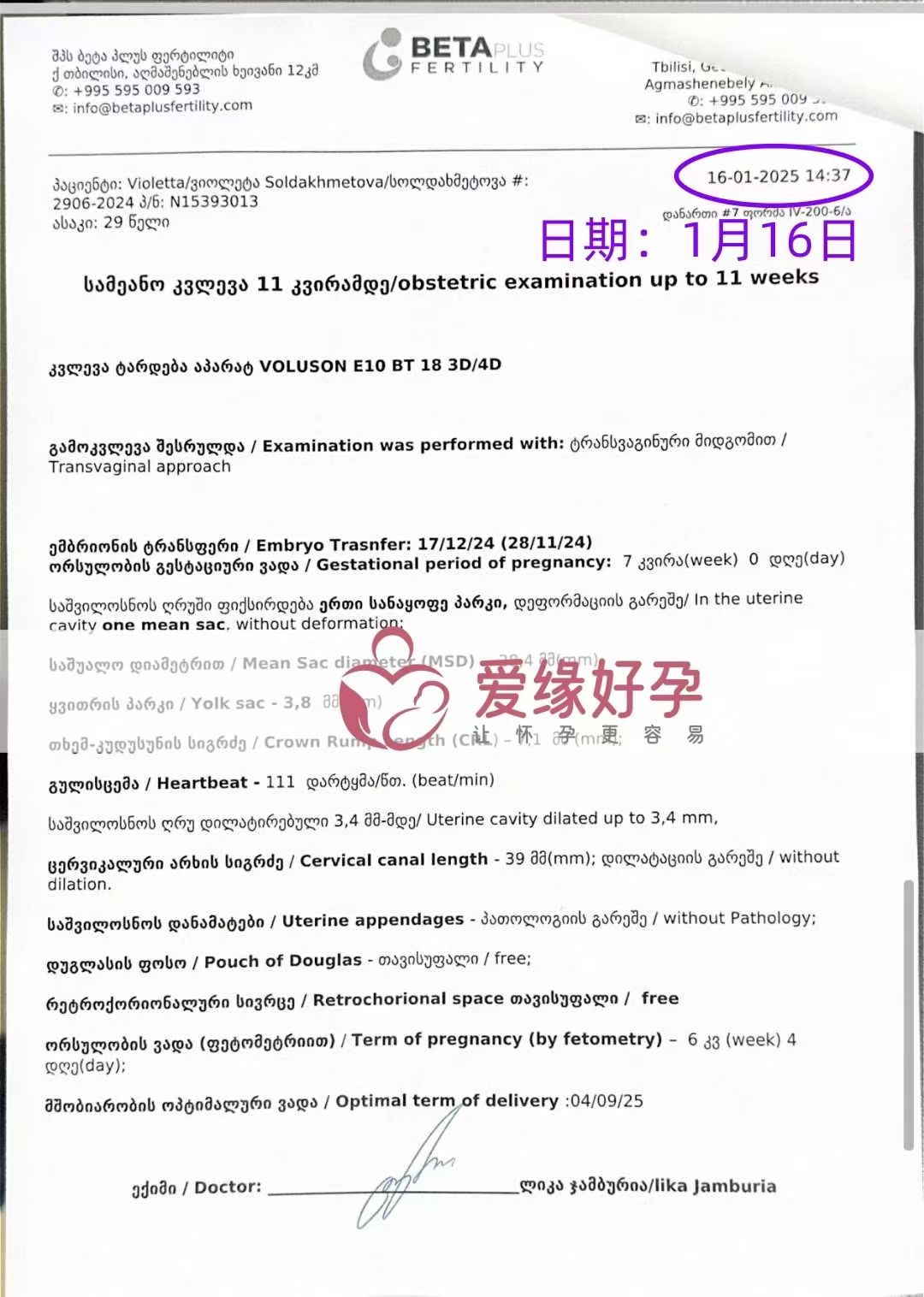 格鲁吉亚代孕代母第一次B超顺利通过