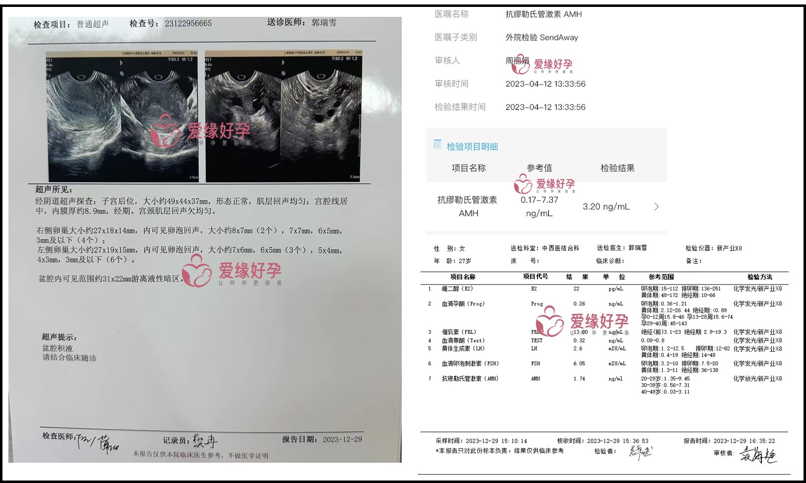 北京夫妇哈萨克斯坦代孕11个月成功得子 | 成功故事