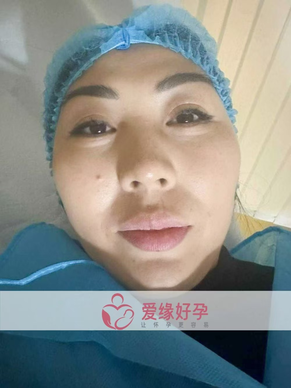 格鲁吉亚代孕代母圆满完成胚胎移植