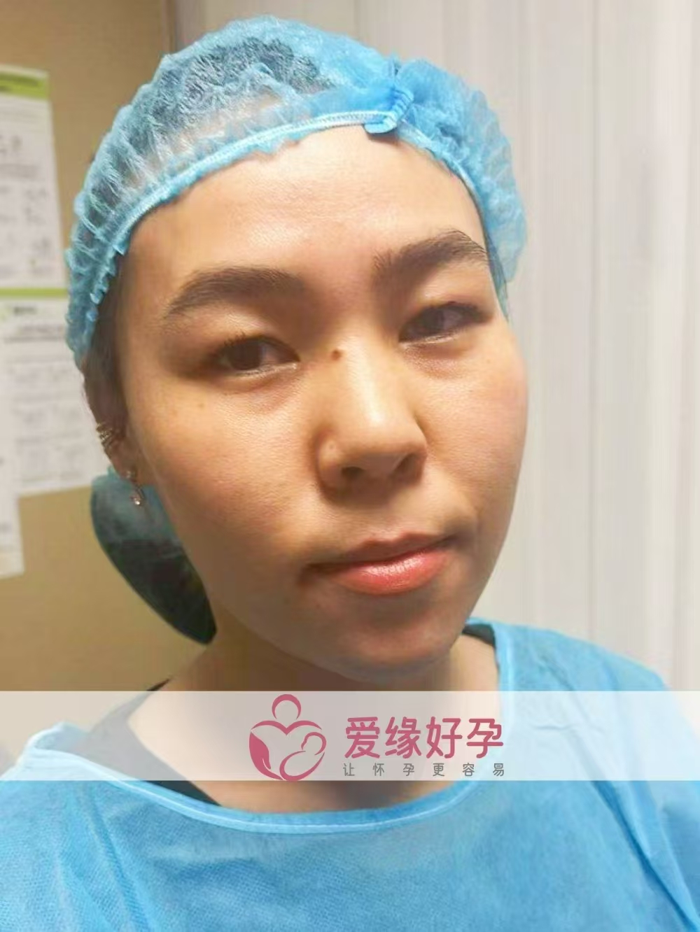 格鲁吉亚代孕代母顺利完成移植