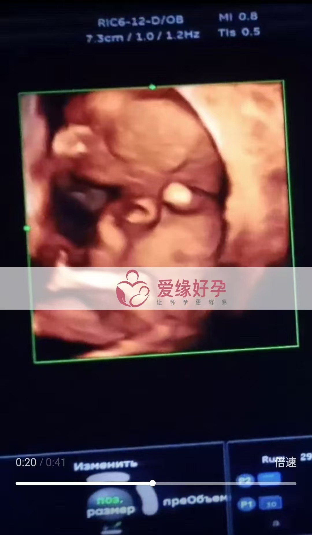 乌克兰代孕代孕代母跨越国界，喜迎新生命