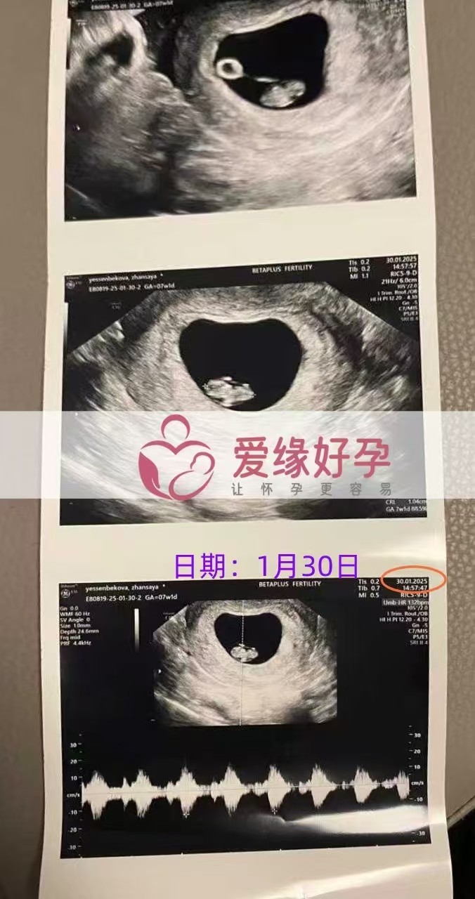 格鲁吉亚代孕代孕代母，新生命迈出第一步