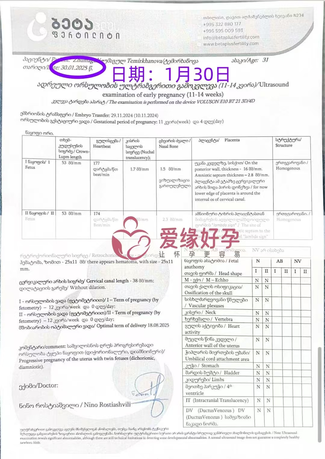 格鲁吉亚代孕代孕代母开启幸福新旅程