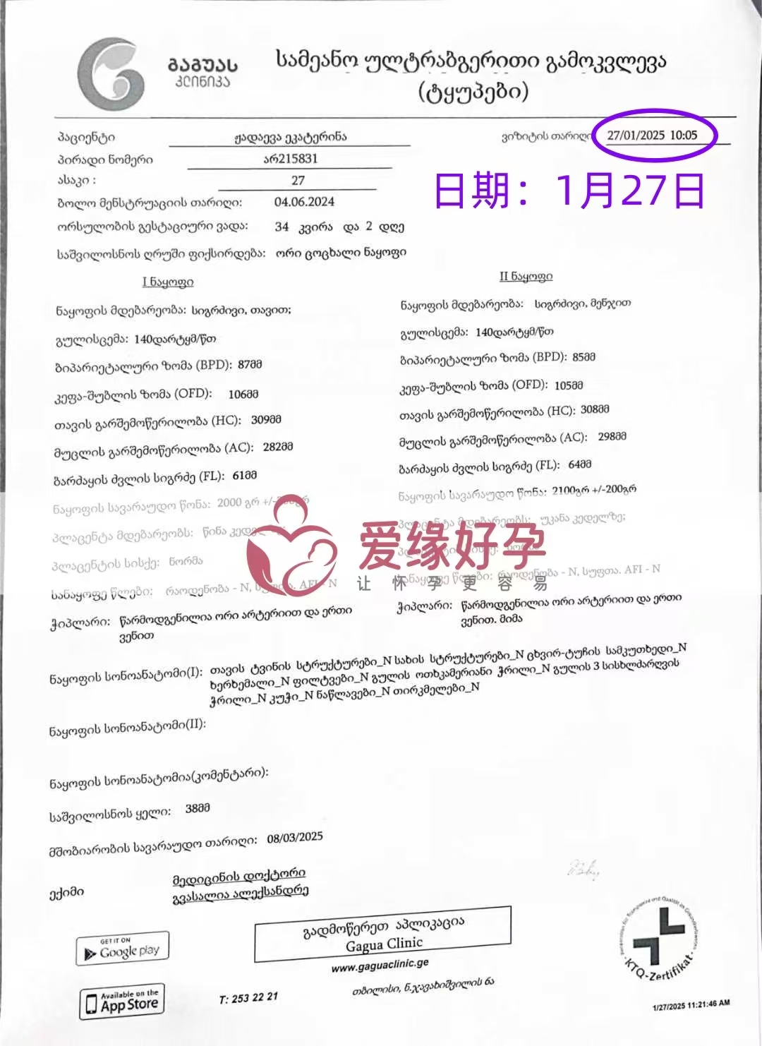格鲁吉亚代孕双胞胎代孕代母34周产检顺利通过