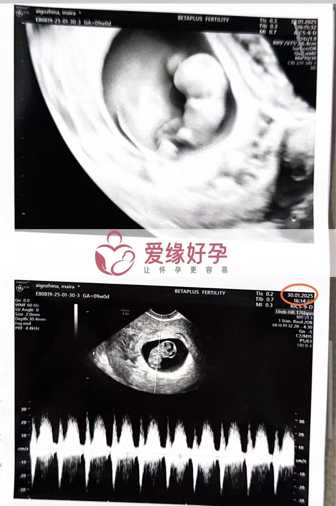 格鲁吉亚代孕代孕代母为新生命加油