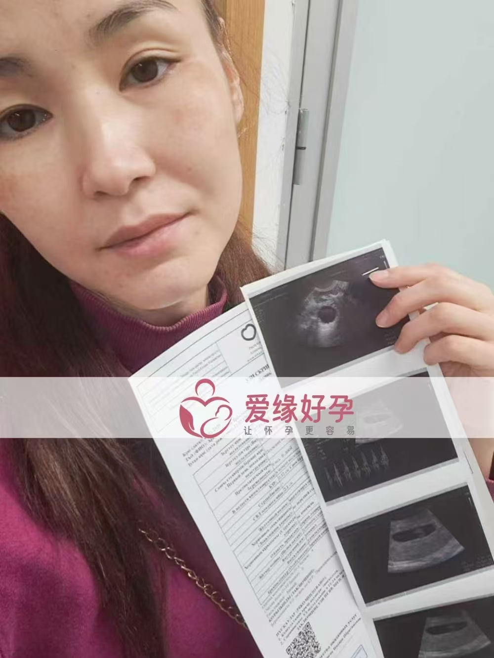 格鲁吉亚代孕代孕代母6周产检顺利通过