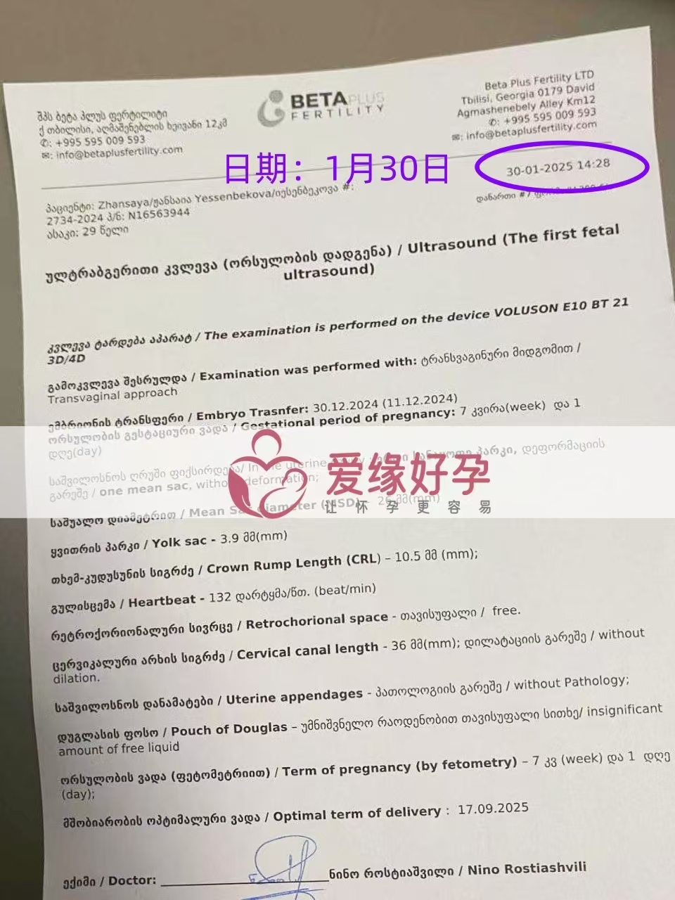 格鲁吉亚代孕代孕代母，新生命迈出第一步
