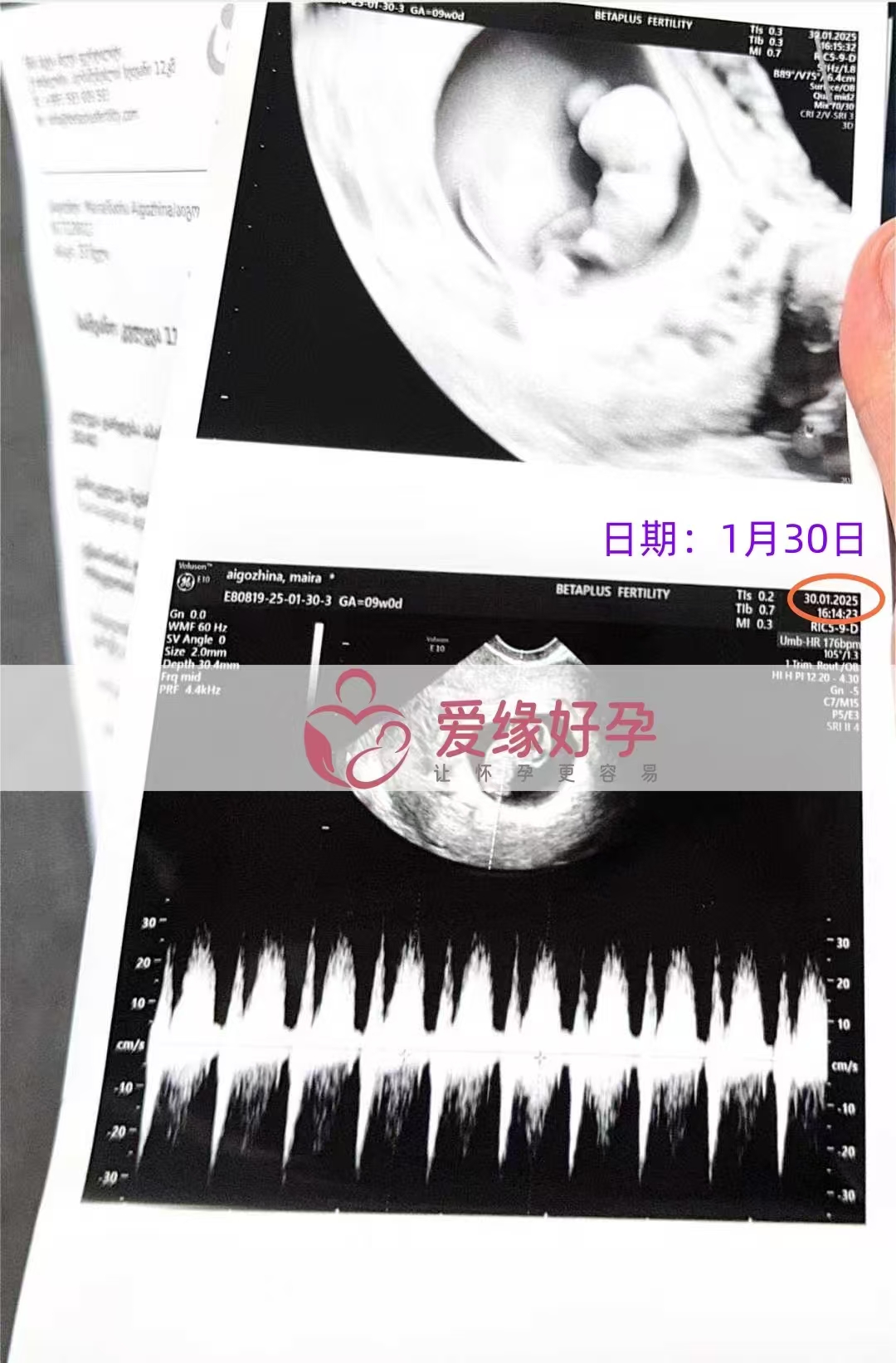 格鲁吉亚代孕代孕代母为新生命加油