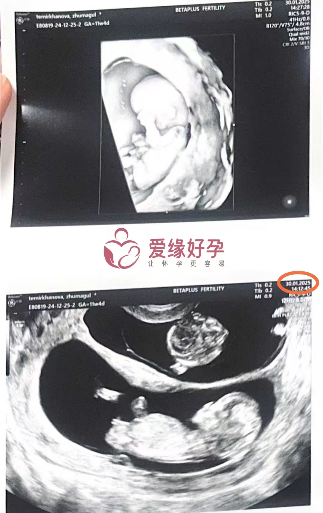 格鲁吉亚代孕代孕代母开启幸福新旅程