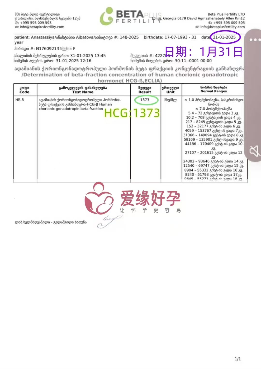 格鲁吉亚代孕代孕代母移植成功