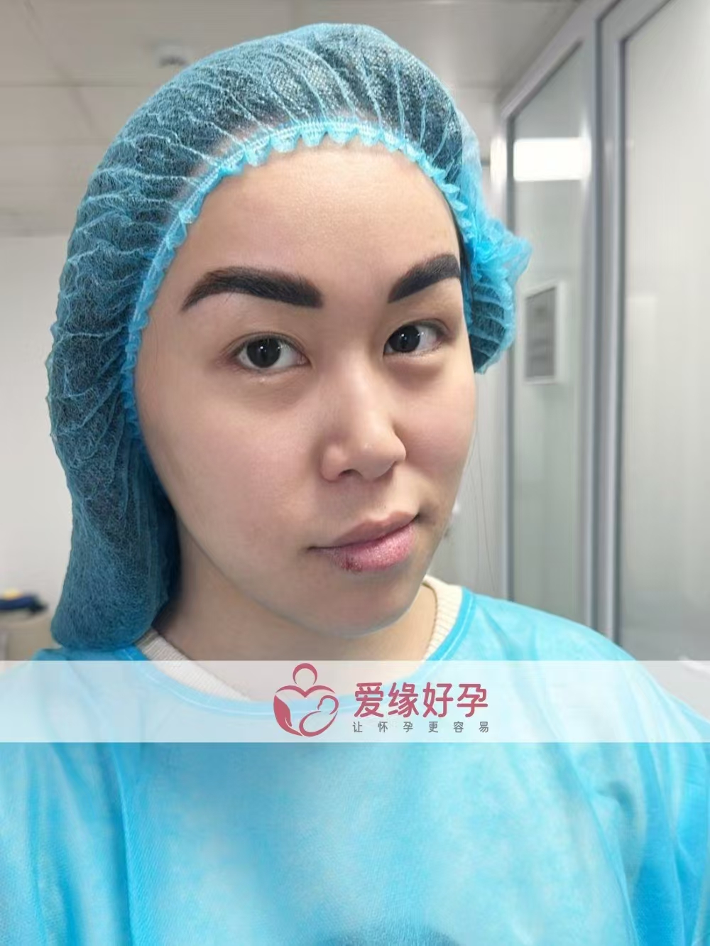 格鲁吉亚代孕代母成功完成移植