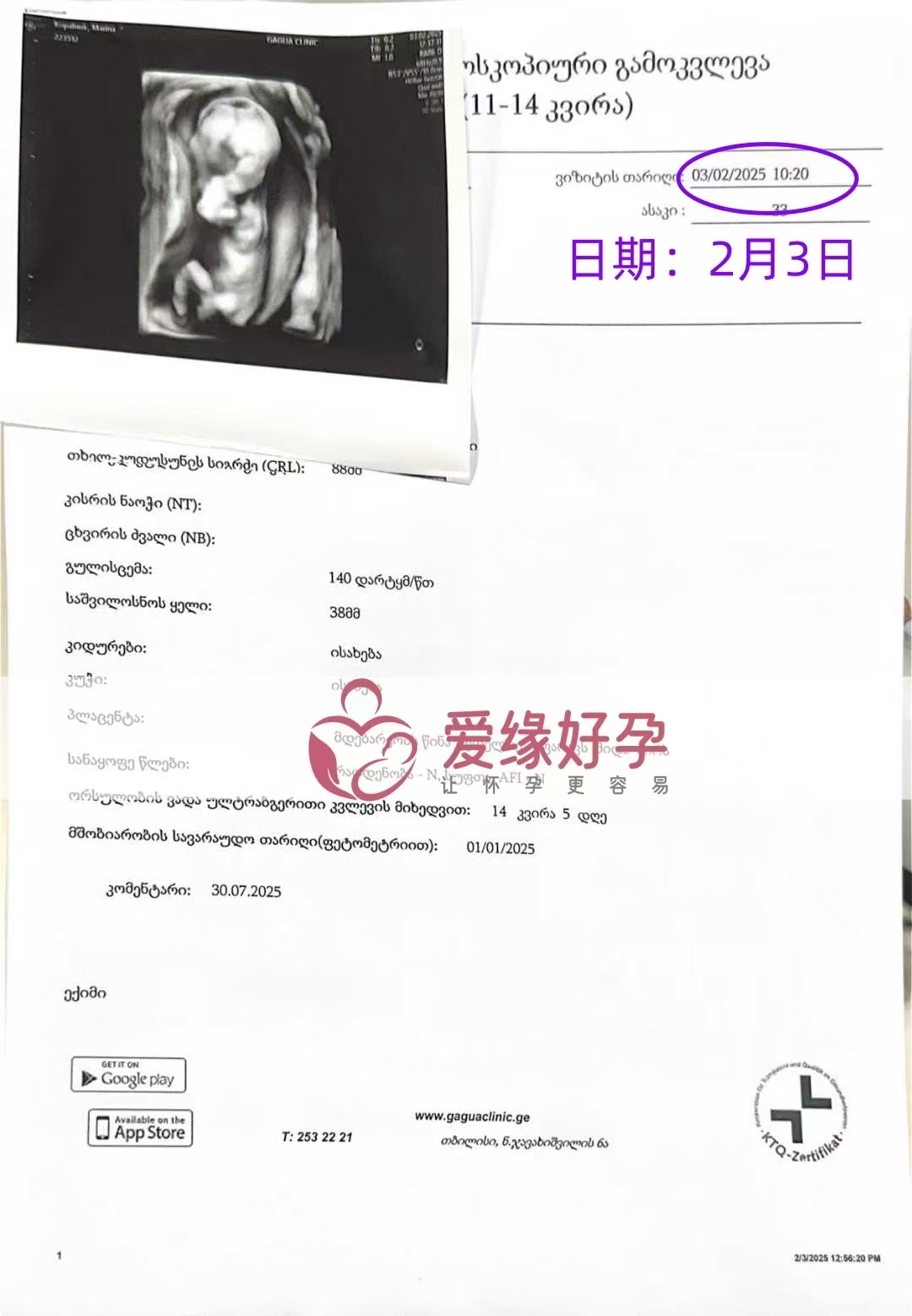 格鲁吉亚代孕代孕代母14周产检顺利通过
