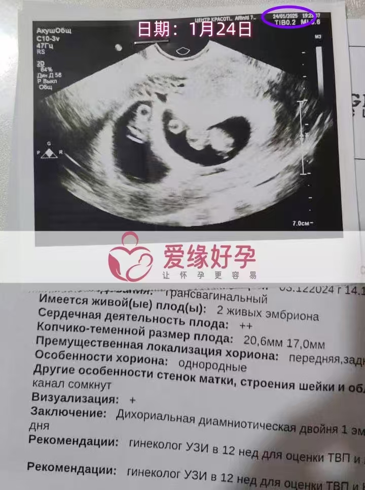 格鲁吉亚代孕代孕代母双胎8周孕检顺利通过