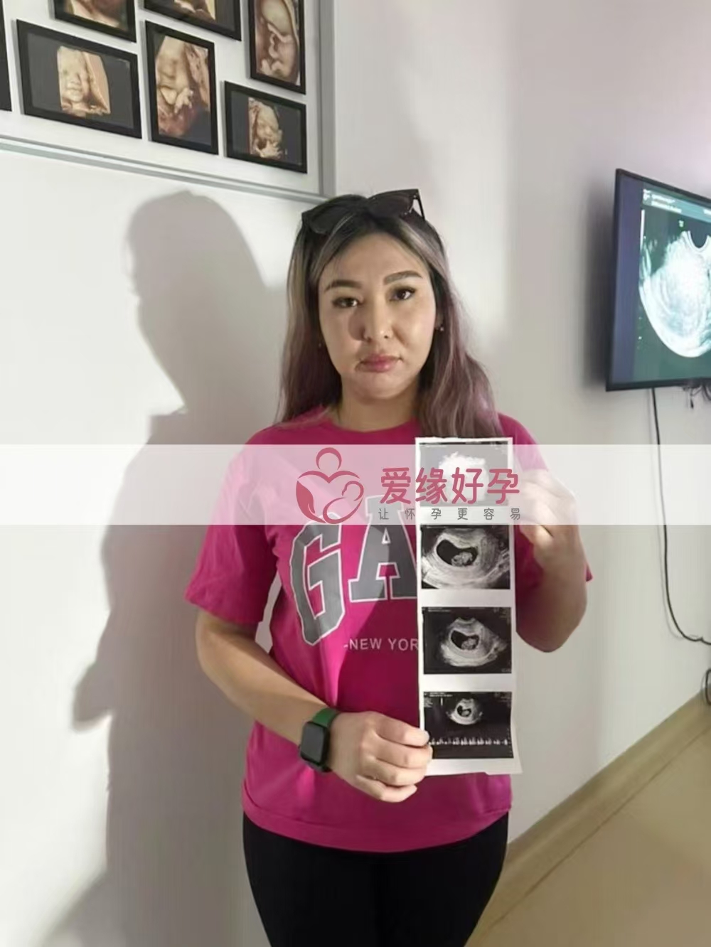 格鲁吉亚代孕代孕代母8周产检顺利通过