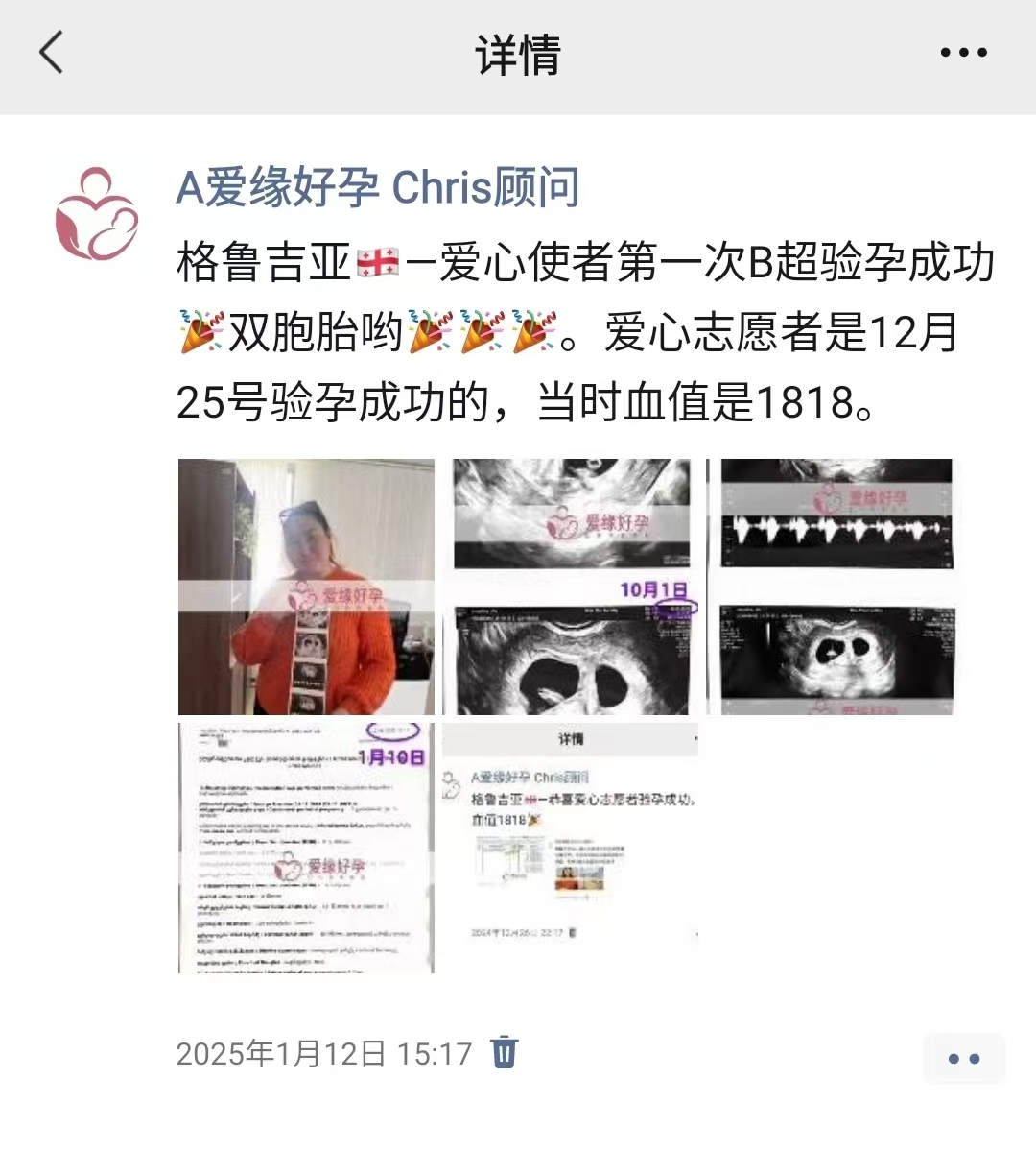 格鲁吉亚代孕代孕代母双胎8周孕检顺利通过