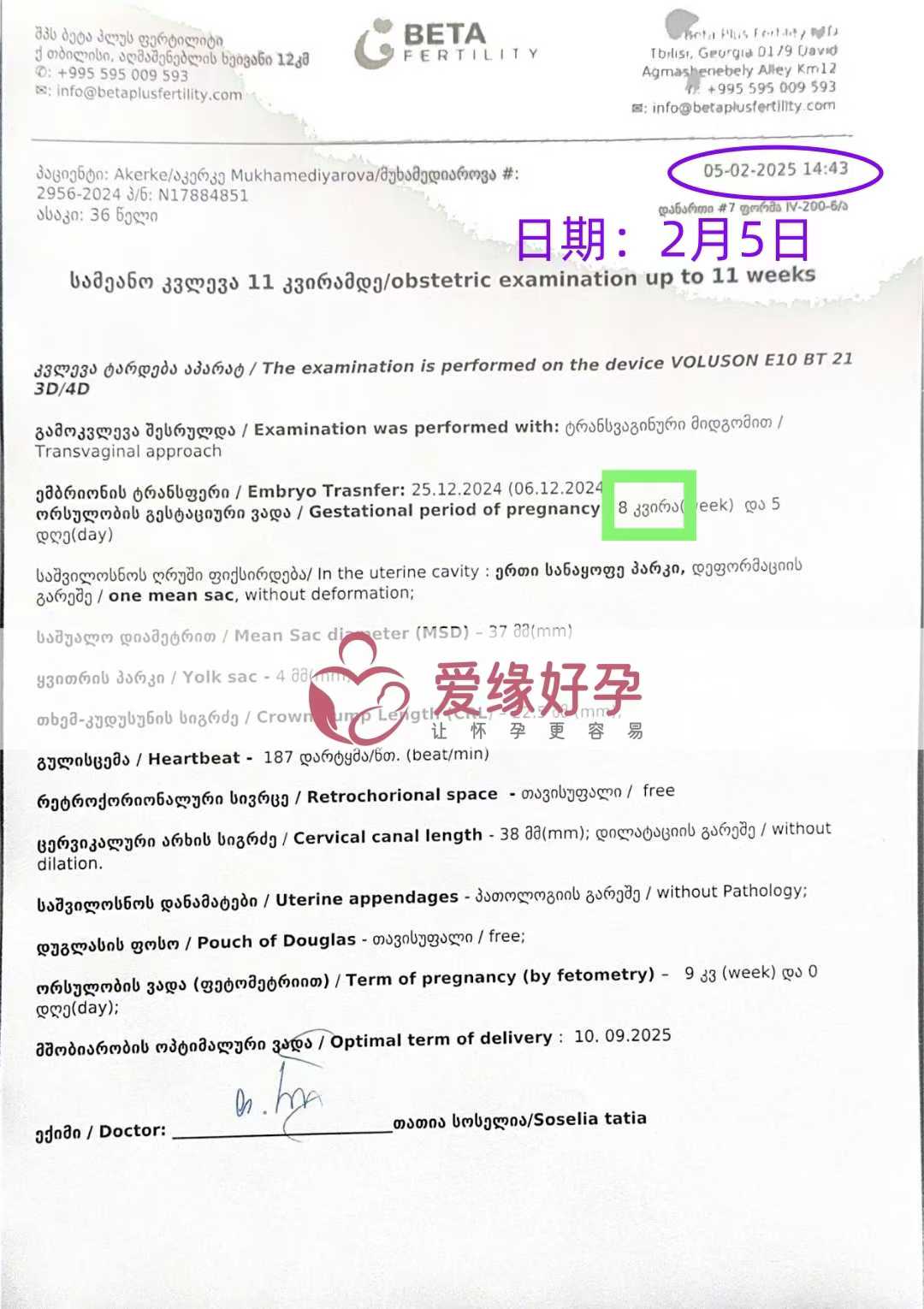 格鲁吉亚代孕代孕代母8周产检进展顺利