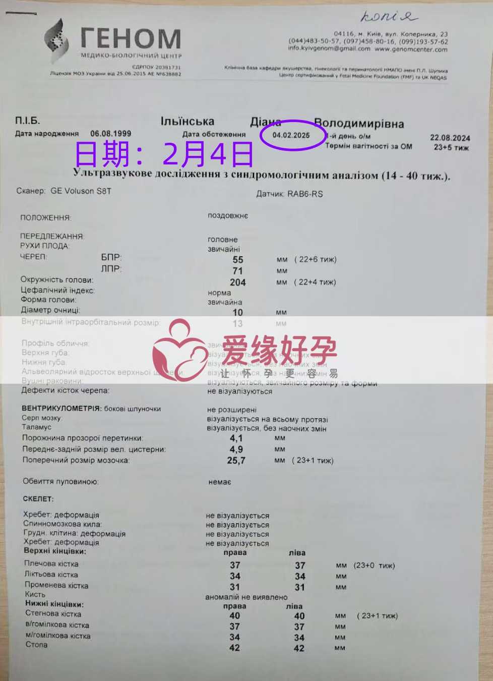 乌克兰代孕代孕代母23周产检顺利通过