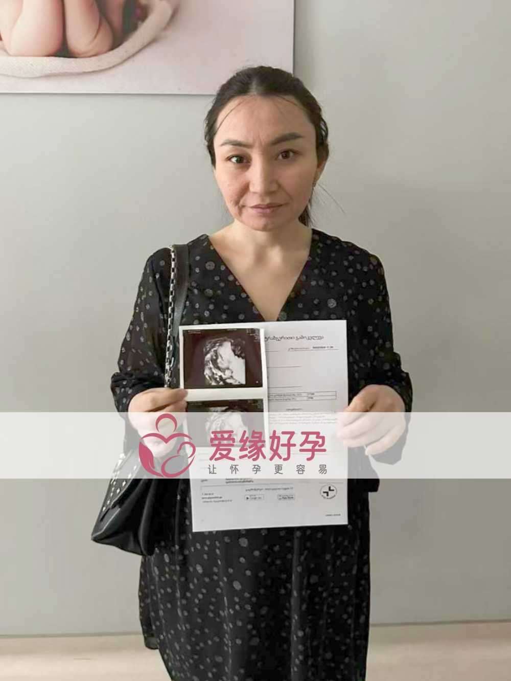 格鲁吉亚代孕代母顺利通过21周产检