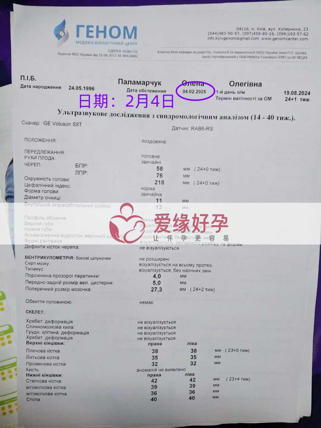 乌克兰代孕代孕代母24周产检顺利通过
