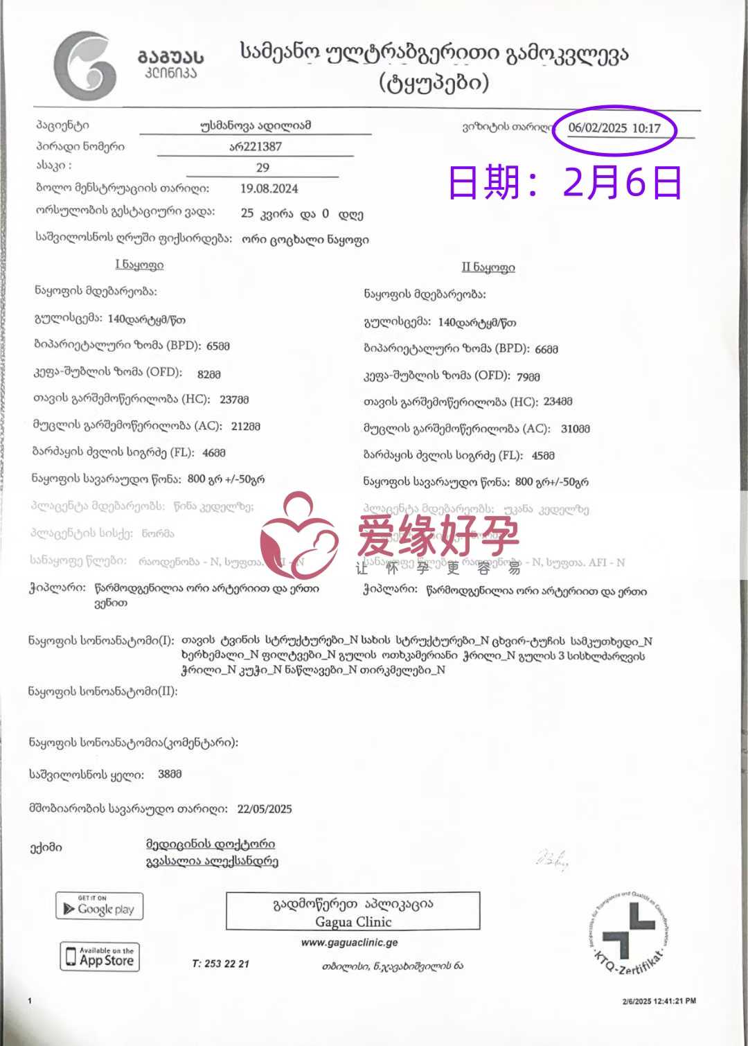 格鲁吉亚代孕代孕代母25周产检顺利通过