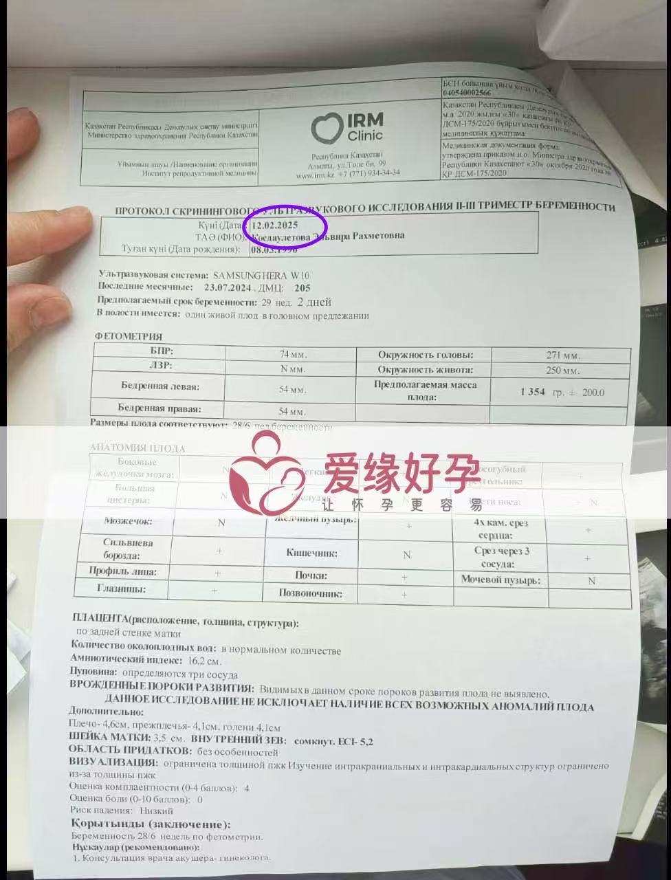 哈萨克斯坦代孕代孕代母29周产检顺利通过