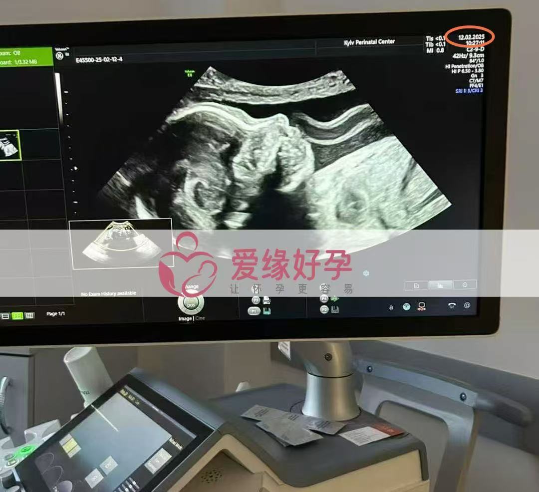 乌克兰代孕代孕代母24周成功通过产检
