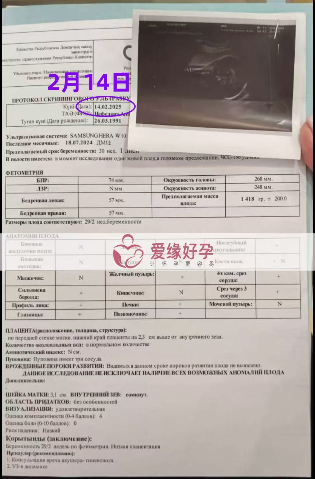 哈萨克斯坦代孕代孕代母30周产检顺利过关