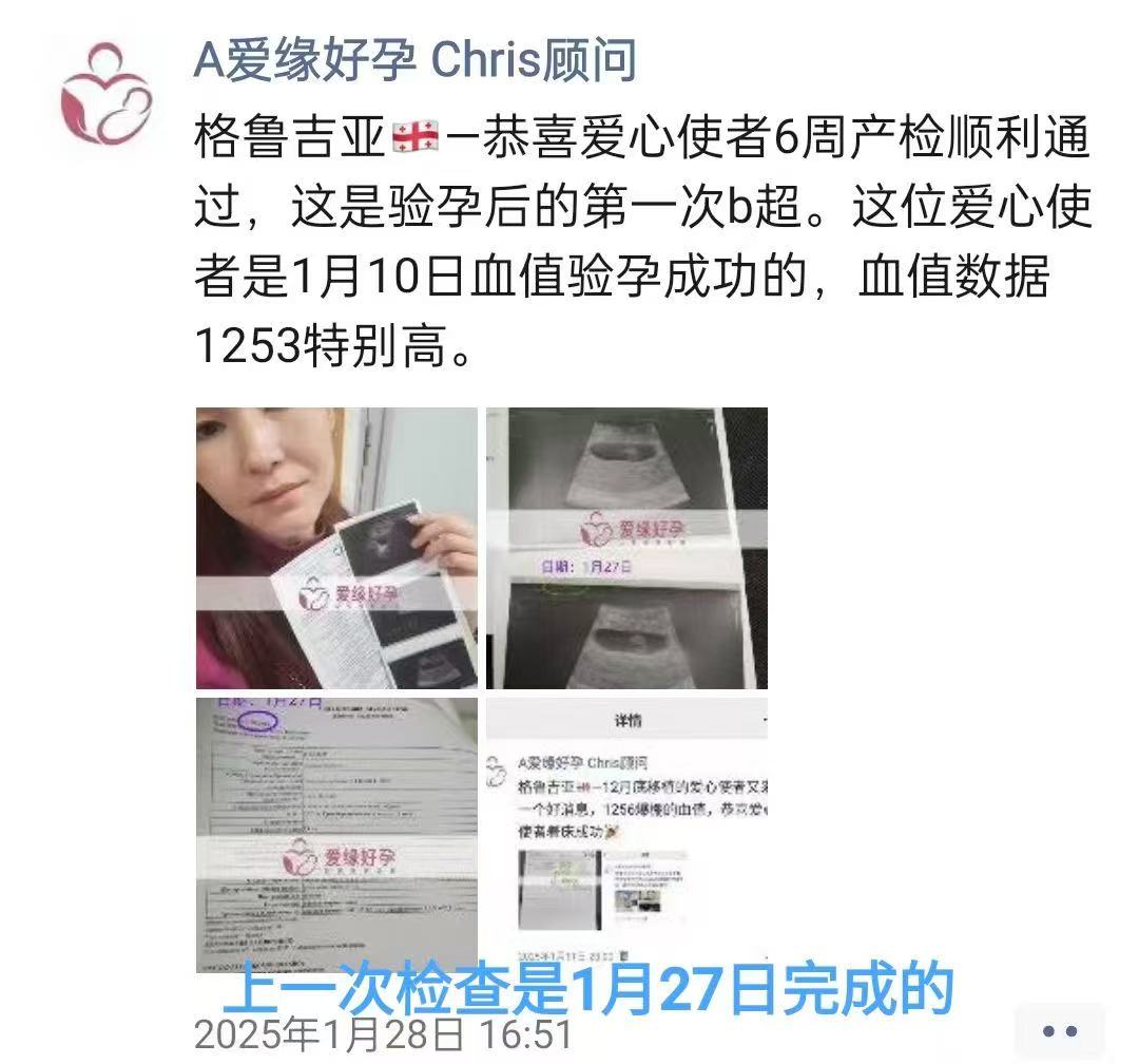 格鲁吉亚代孕代孕代母14周产检结果安好