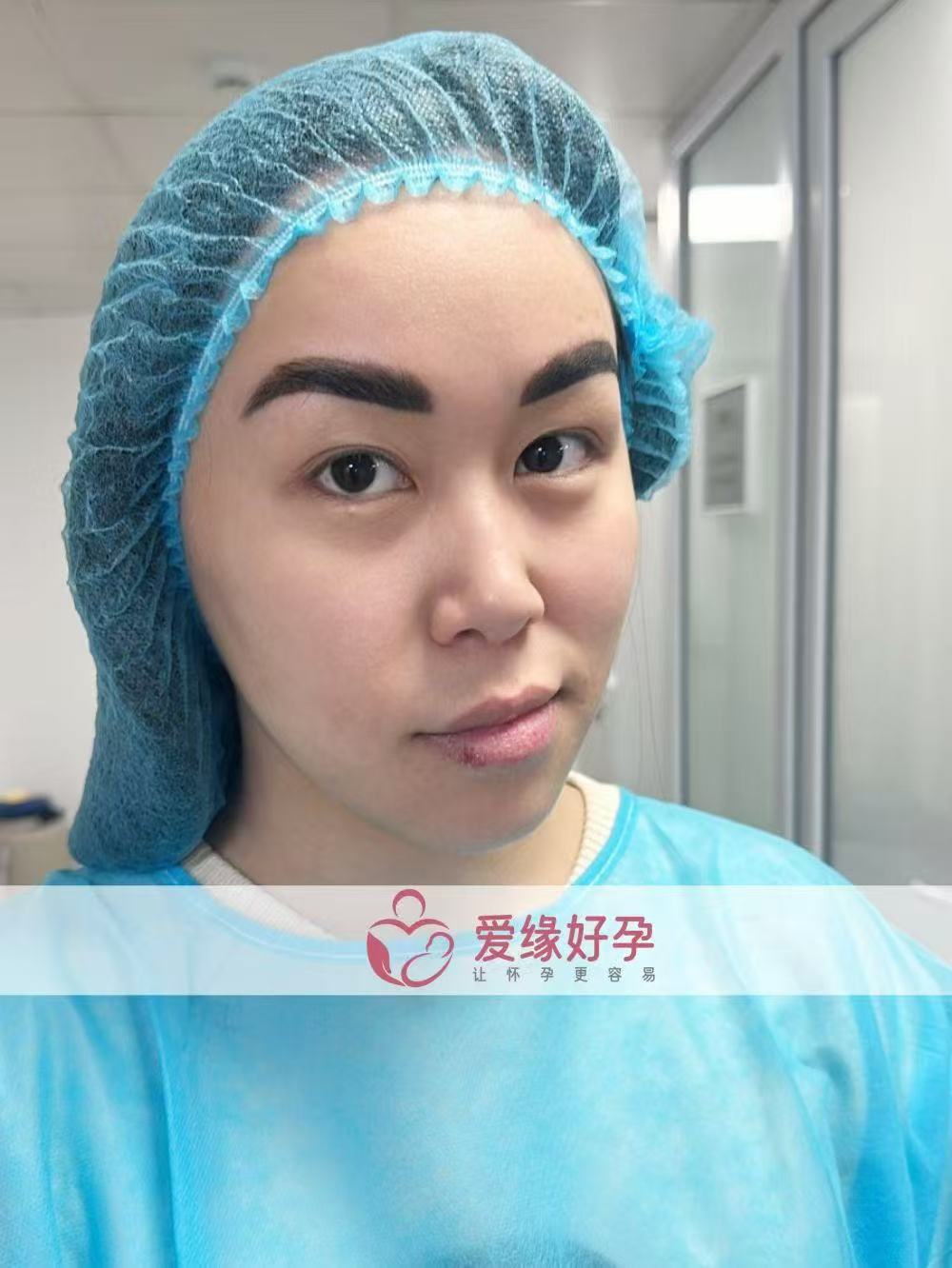 格鲁吉亚代孕代孕代母胚胎着床成功