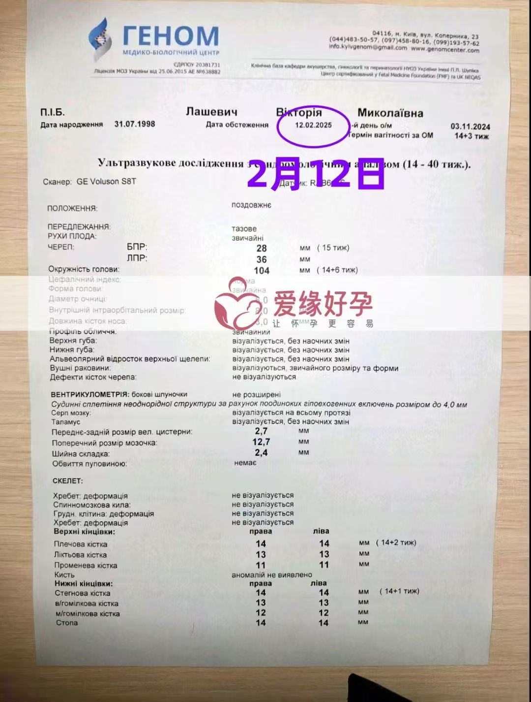 乌克兰代孕代孕代母产检身体恢复正常