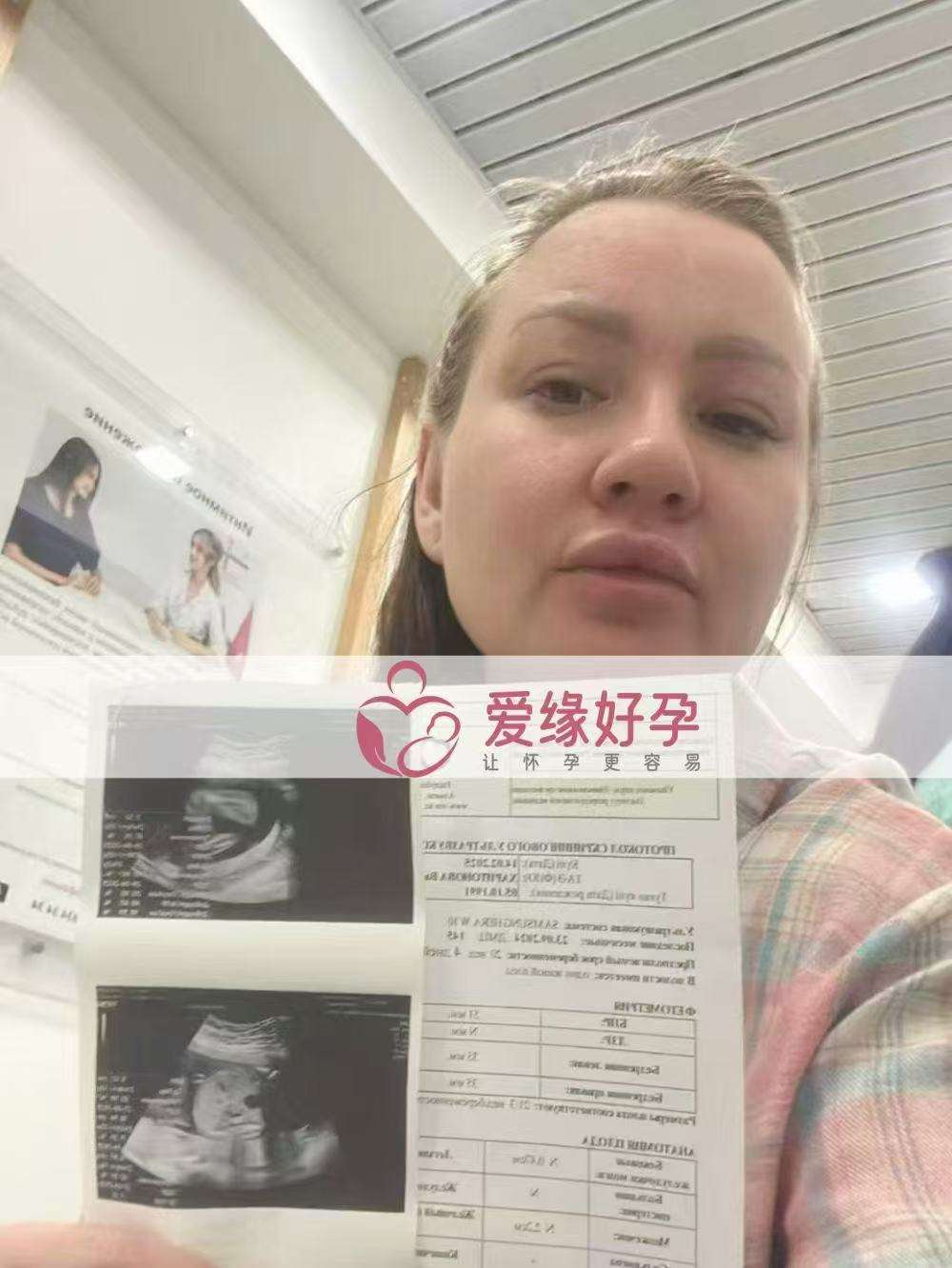 哈萨克斯坦代孕代母20周产检顺利通过