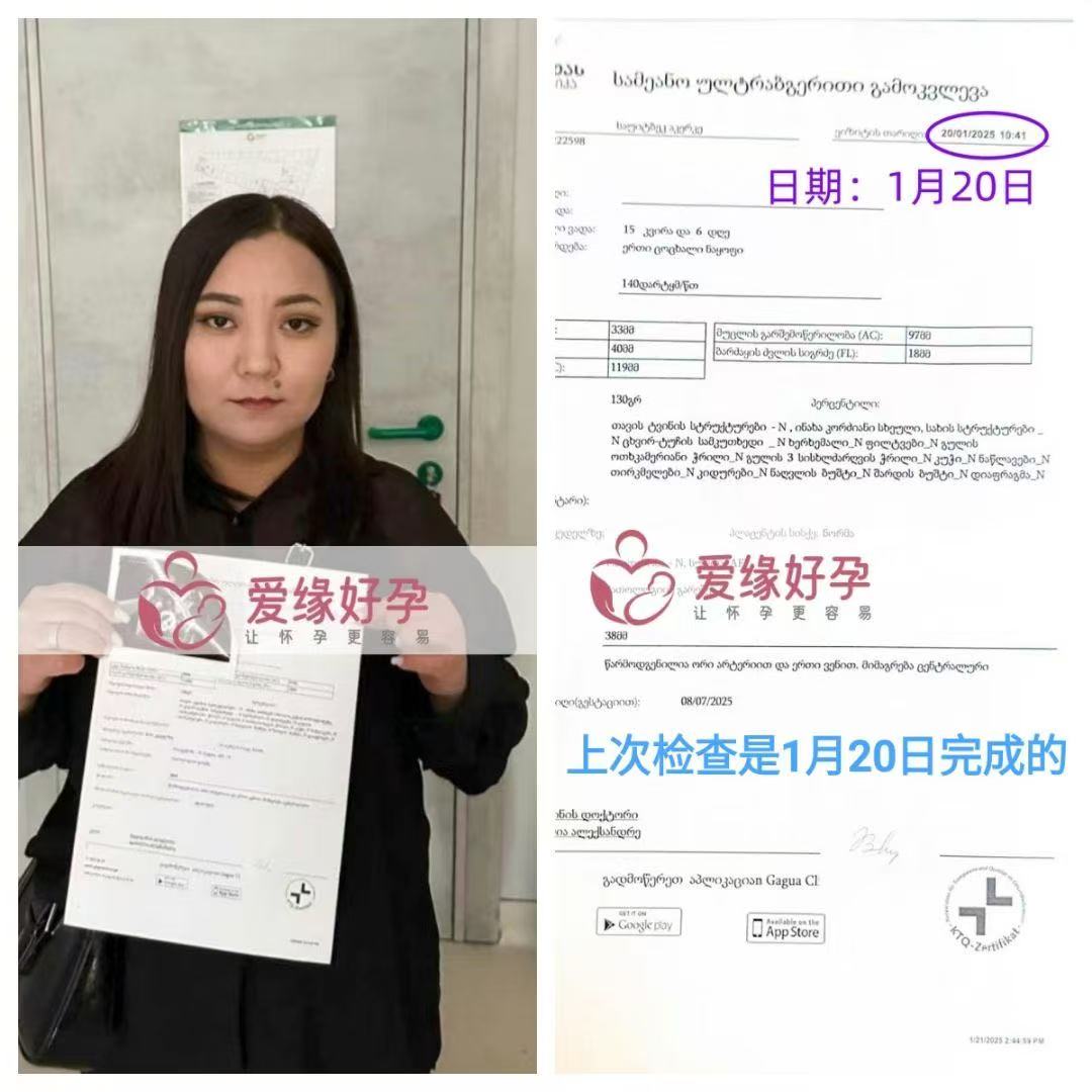 格鲁吉亚代孕代孕代母18周产检顺利通过