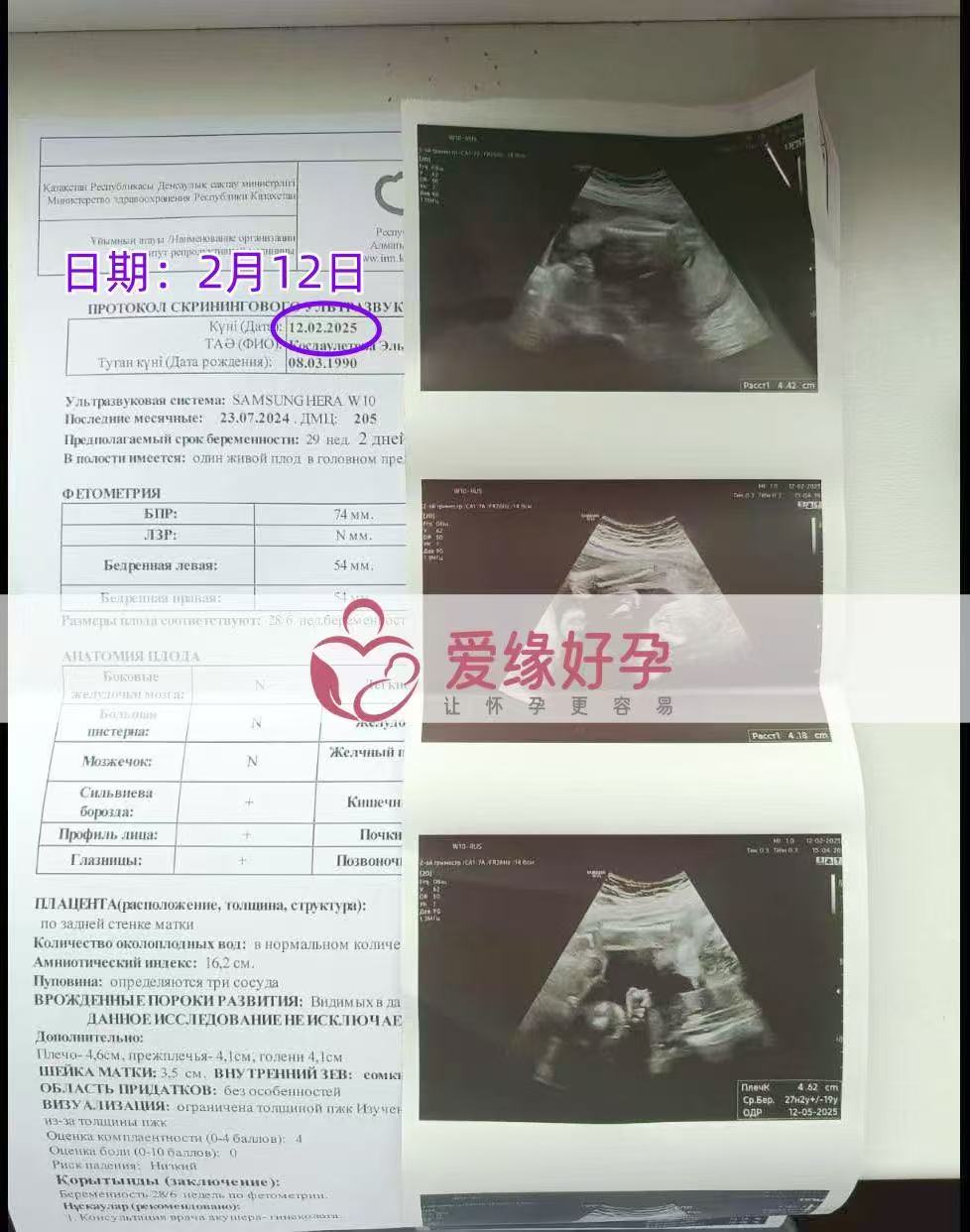 哈萨克斯坦代孕代孕代母29周产检顺利通过