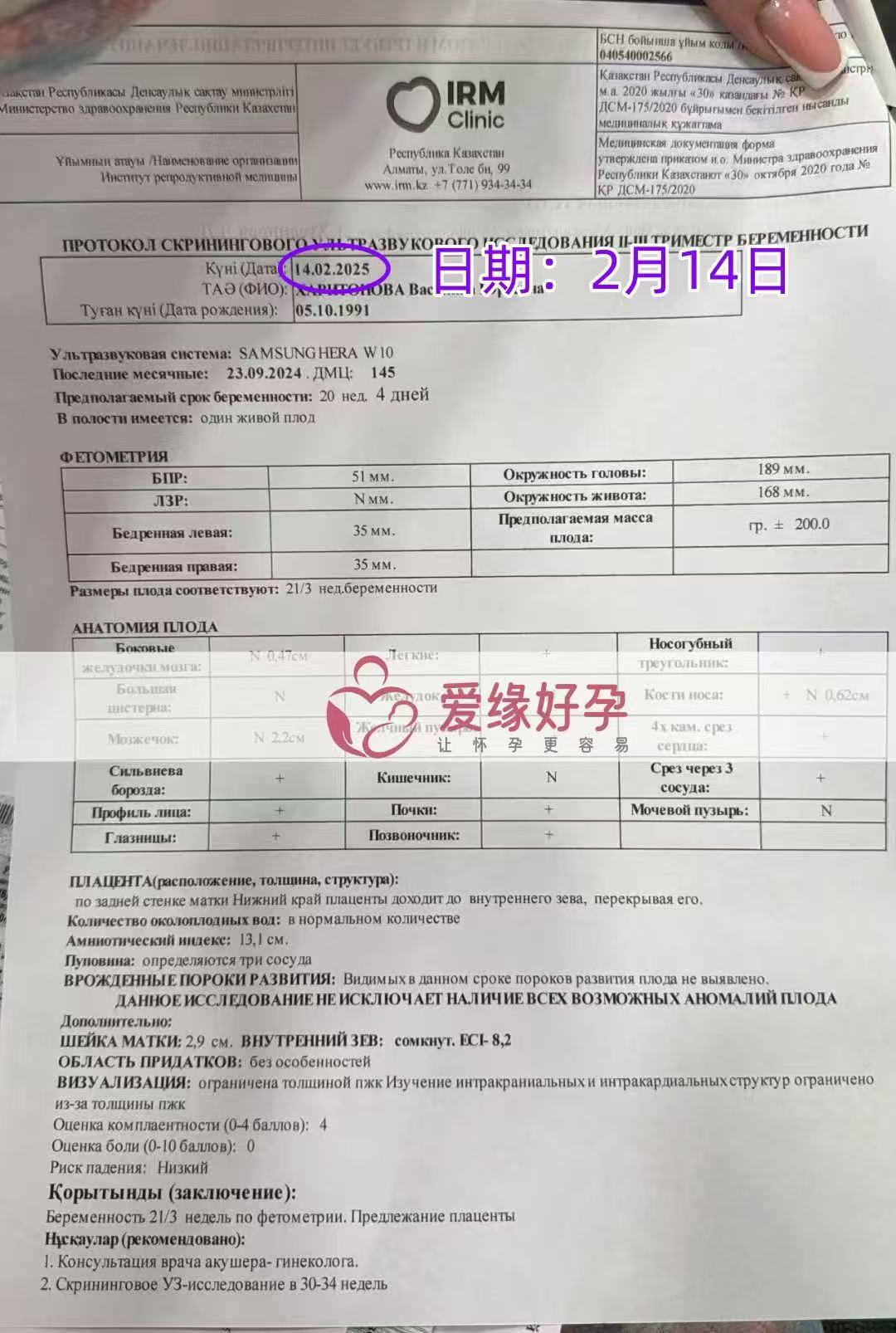 哈萨克斯坦代孕代孕代母20周产检顺利通过