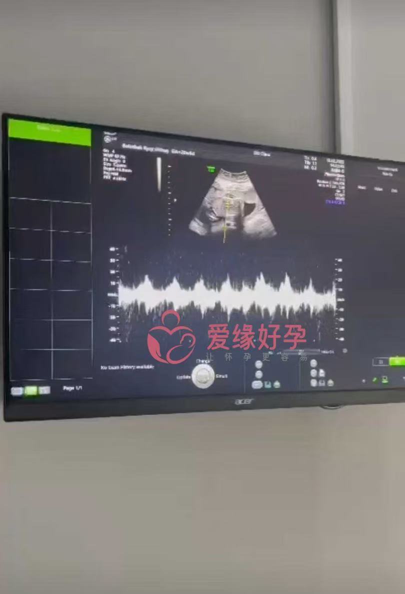 格鲁吉亚代孕代孕代母成功通过20周产检
