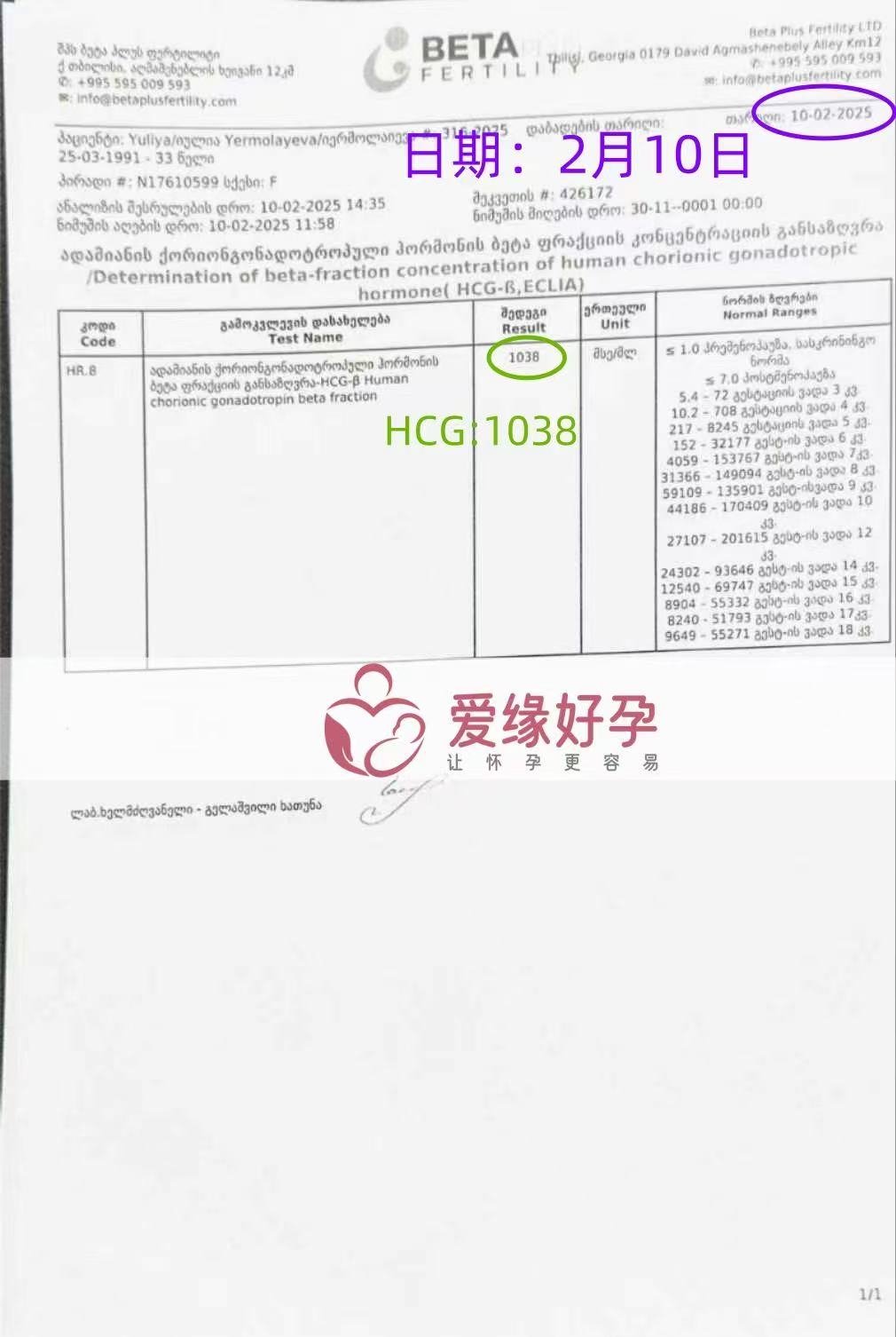 格鲁吉亚代孕代孕代母胚胎成功发芽