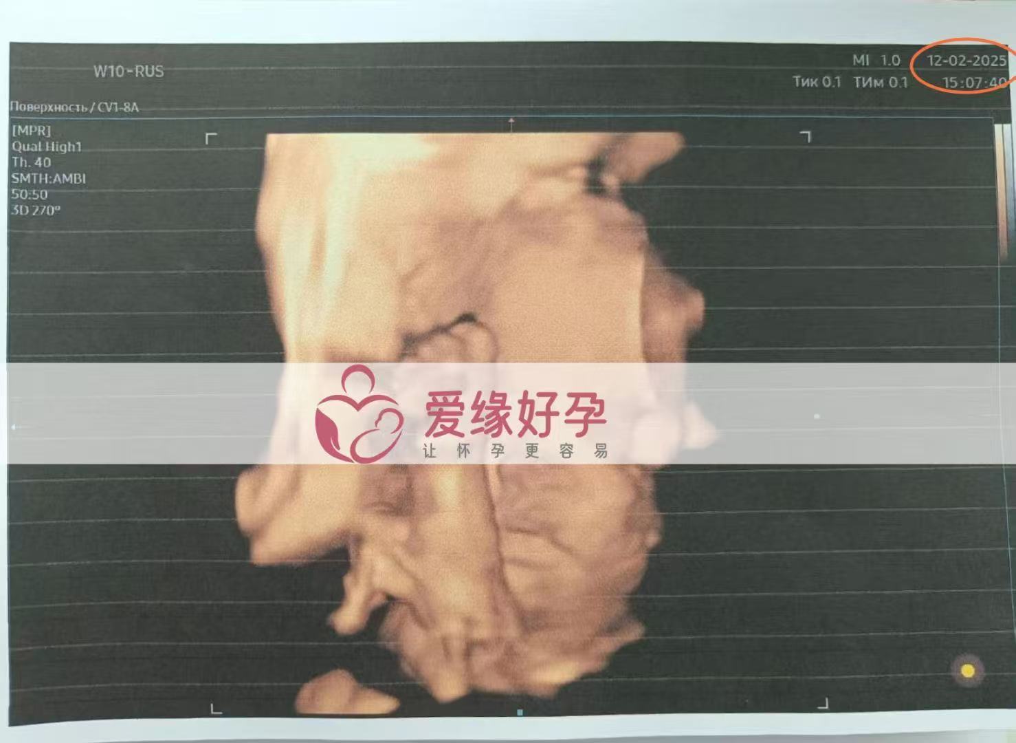 哈萨克斯坦代孕代孕代母29周产检顺利通过