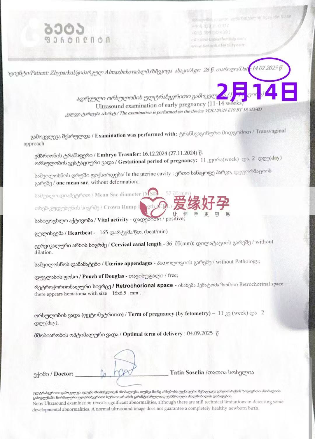 格鲁吉亚代孕代孕代母11周产检顺利通过