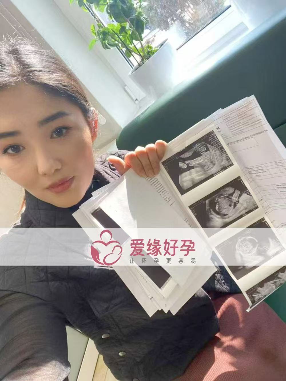 哈萨克斯坦代孕代孕代母20周产检顺利通过