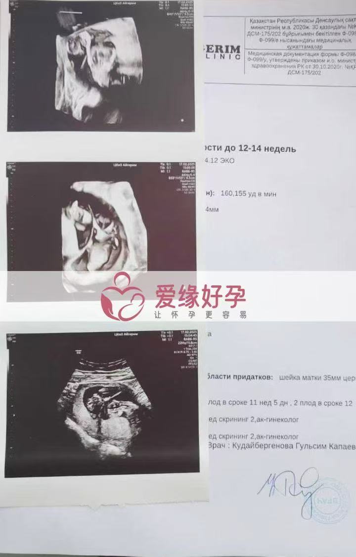 格鲁吉亚代孕双胎代孕代母12周产检顺利通过