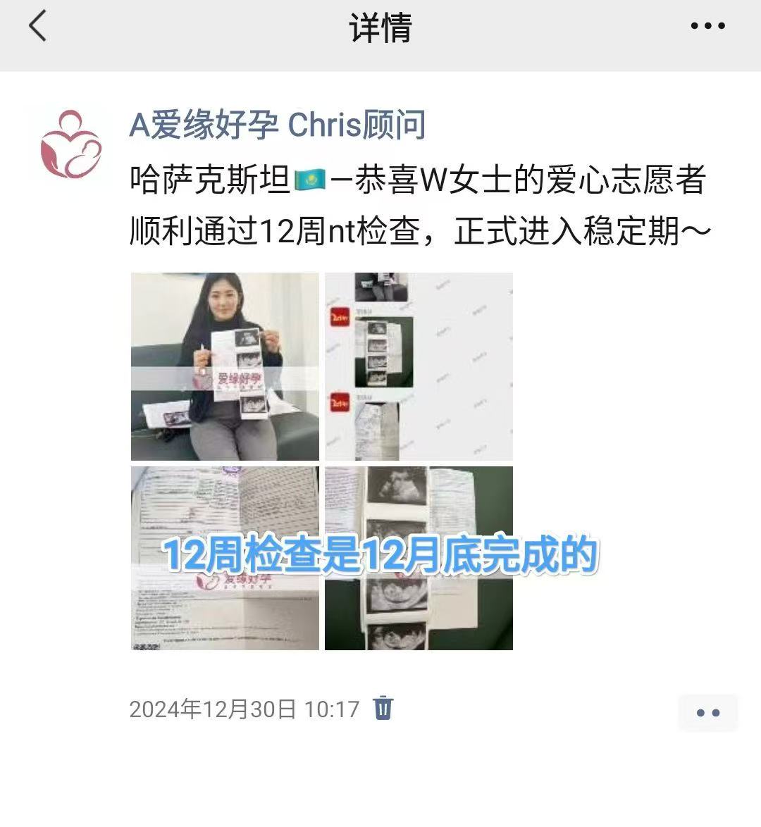 哈萨克斯坦代孕代孕代母20周产检顺利通过