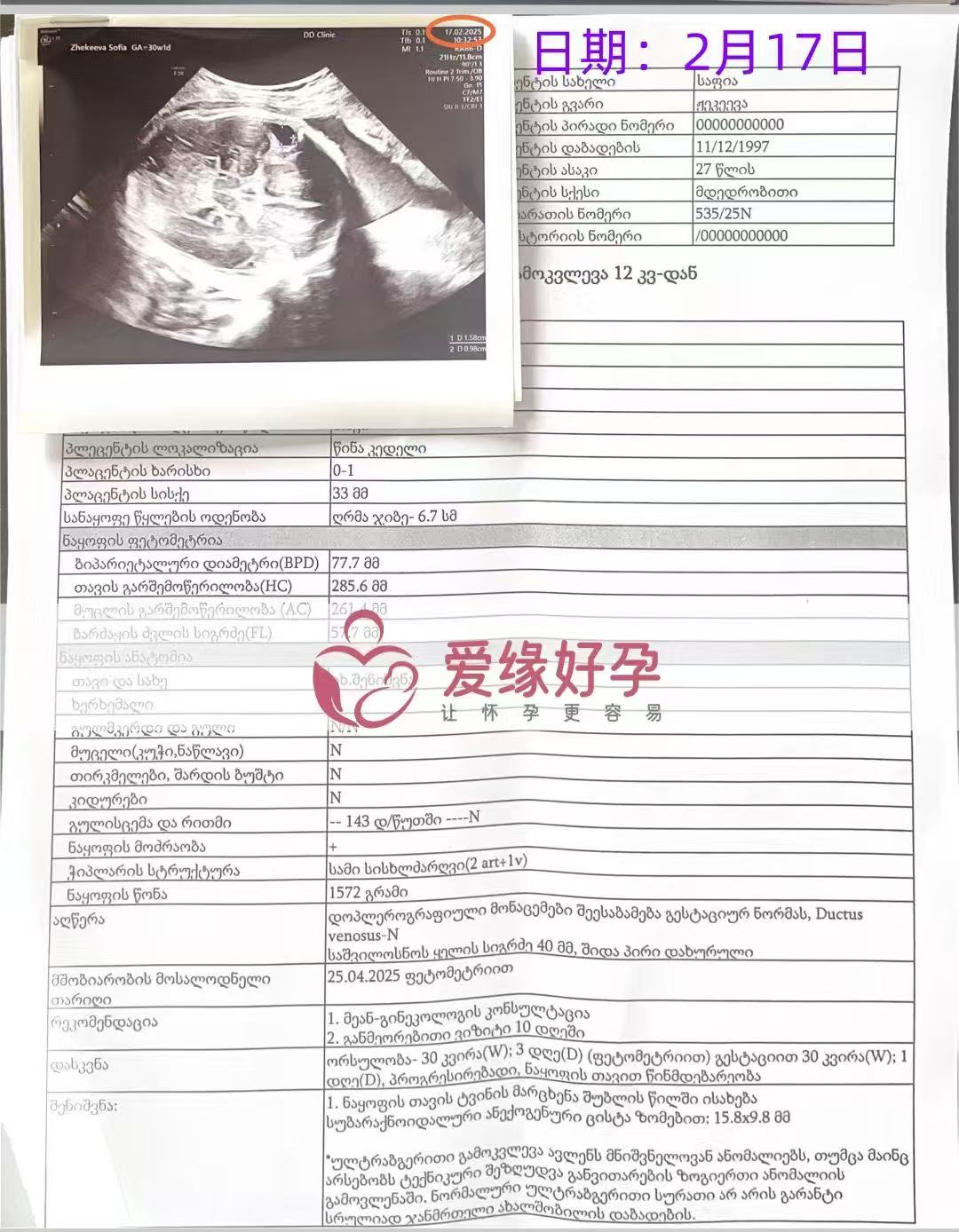 格鲁吉亚代孕代孕代母30周产检顺利通过