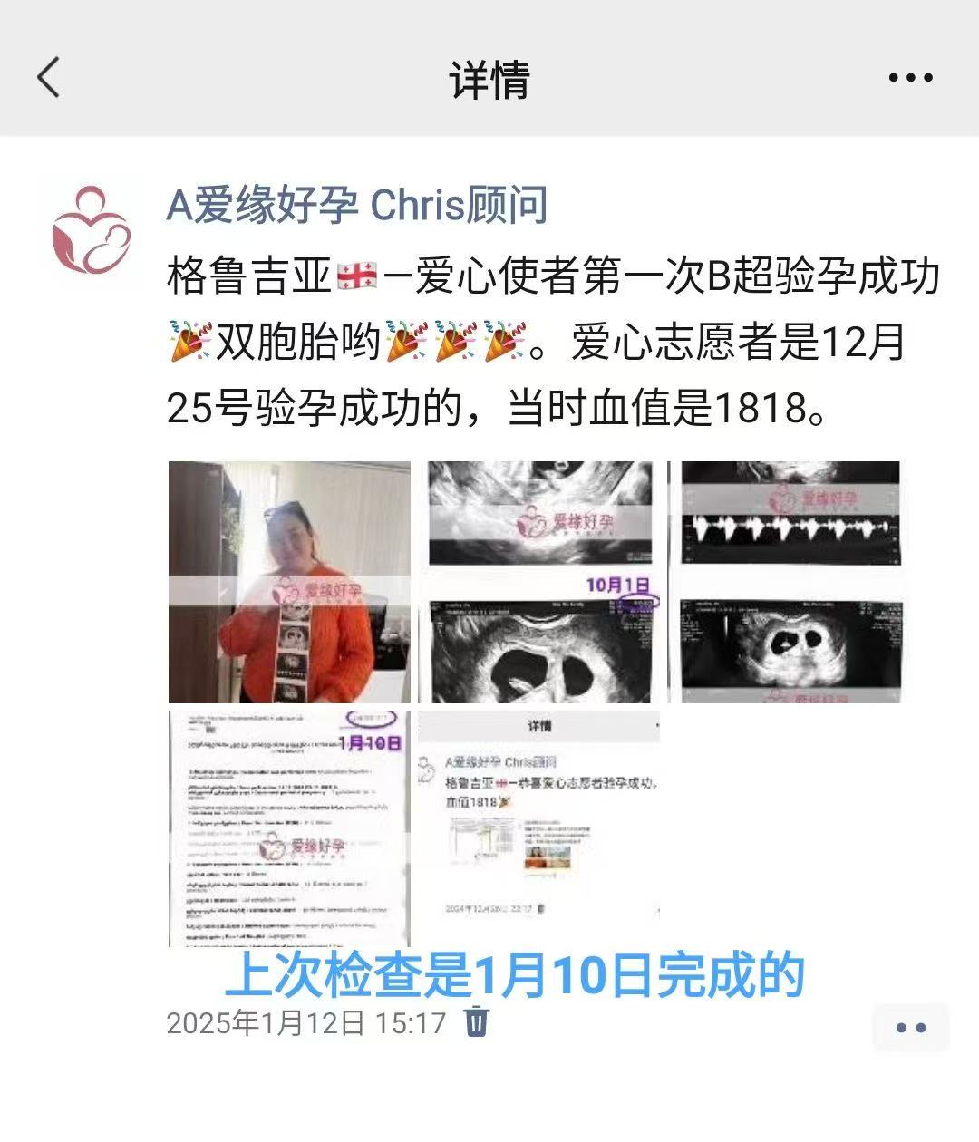 格鲁吉亚代孕双胎代孕代母12周产检顺利通过