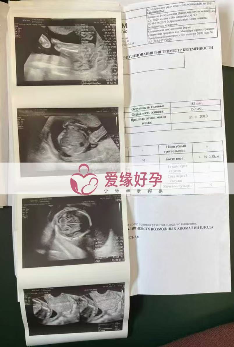 哈萨克斯坦代孕代孕代母20周产检顺利通过