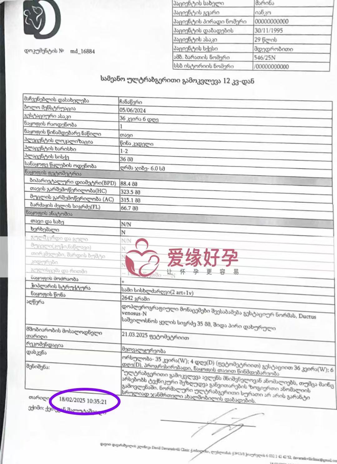 格鲁吉亚代孕代孕代母即将迎接新生命诞生