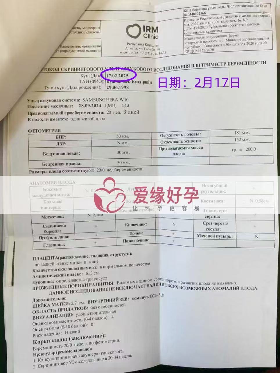 哈萨克斯坦代孕代孕代母20周产检顺利通过