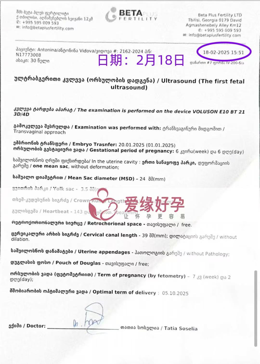 格鲁吉亚代孕代孕代母6周第一次产检完美通过