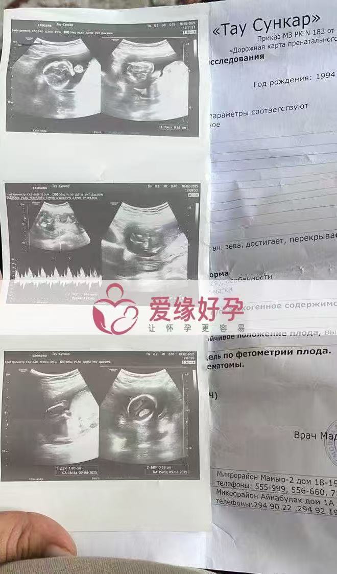格鲁吉亚代孕代孕代母15周产检顺利通过